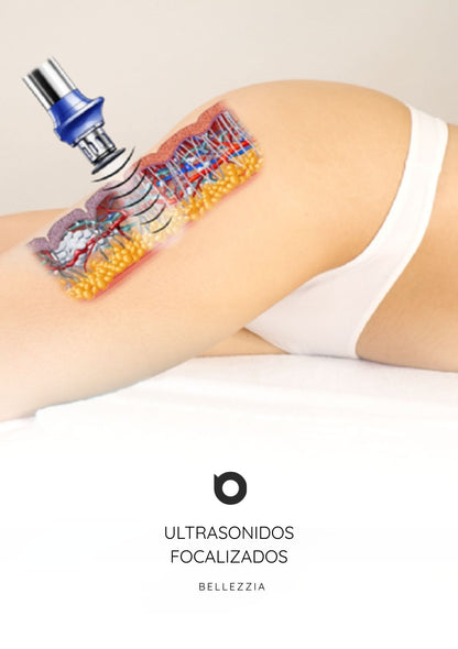 HIFU Corporal 7D | Ultrasonidos Focalizados