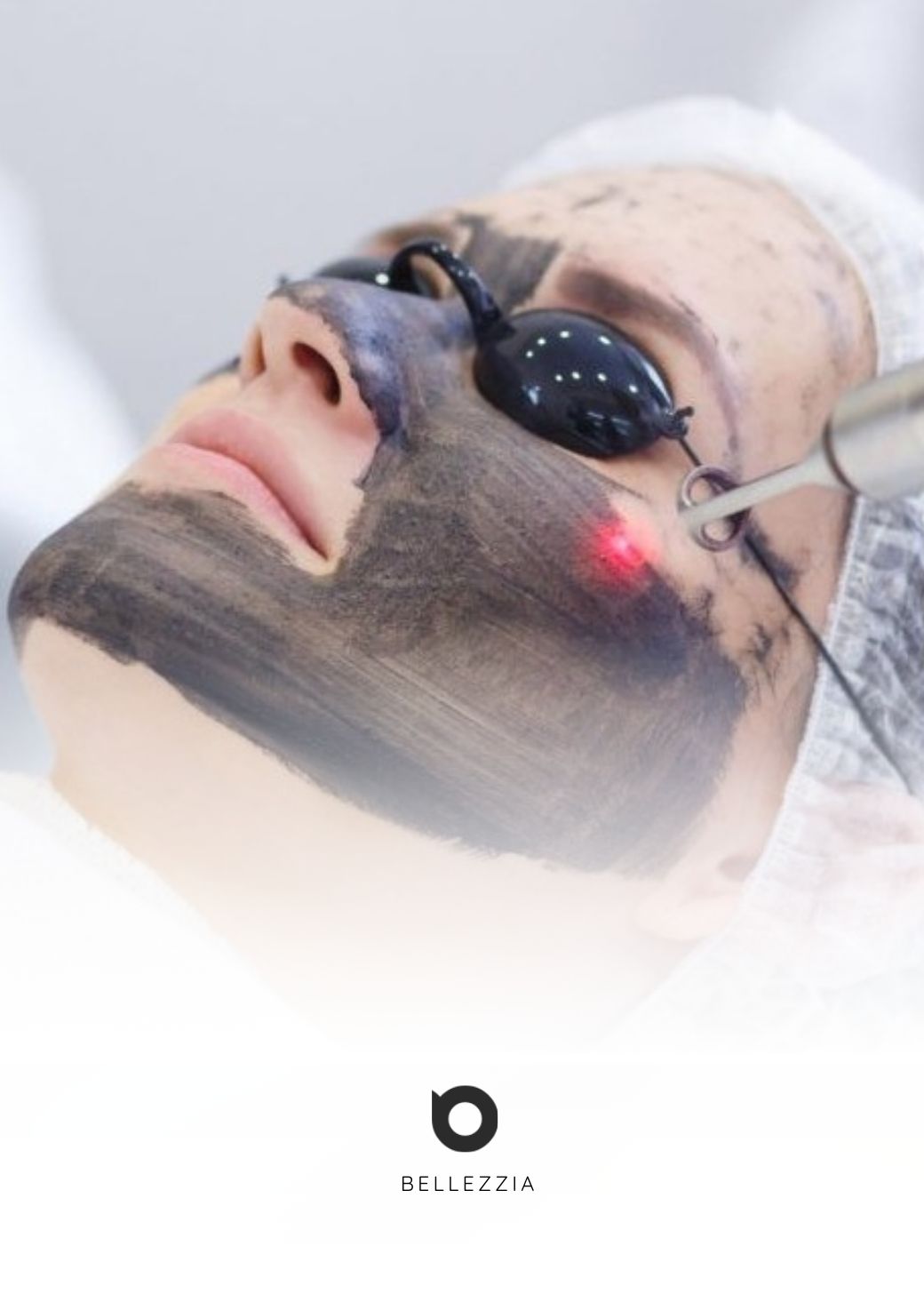 Peeling de carbon activado con láser - Hollywood Peel