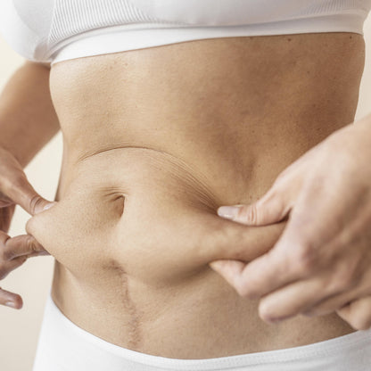 Criolipolisis Corporal Inteligente con CRYOCOOL® MED