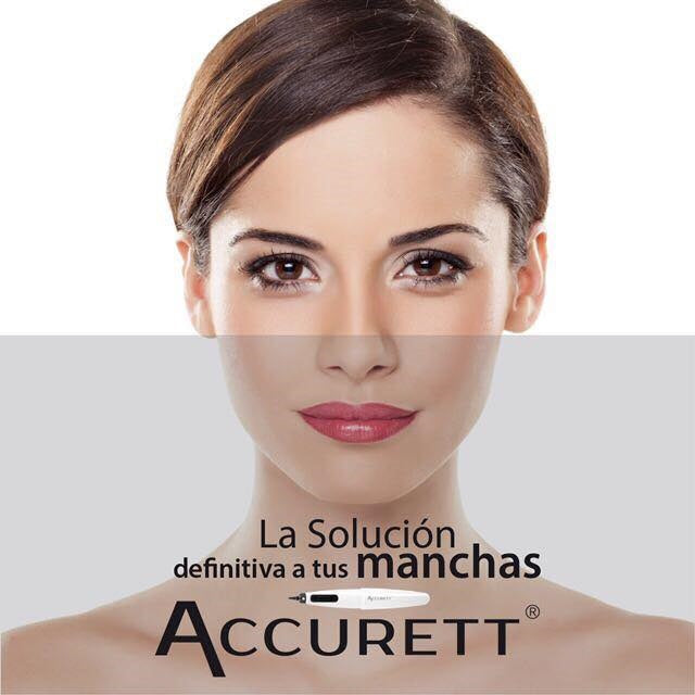 Eliminación de Manchas con Crioterapia