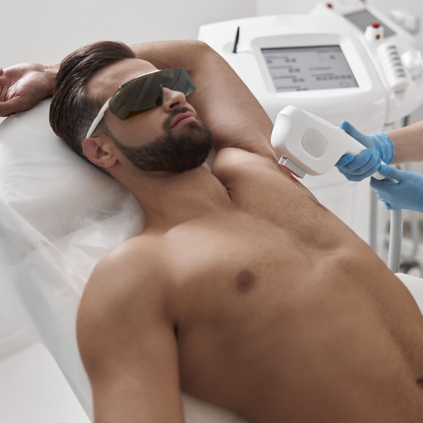 Depilación Láser Masculina