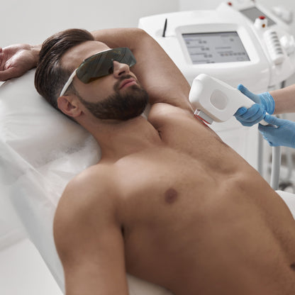 Depilación Láser Masculina