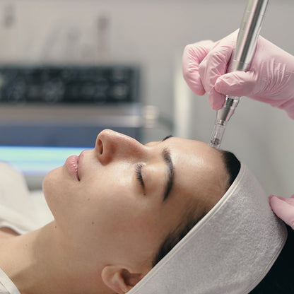 Dermapen Facial con Peeling