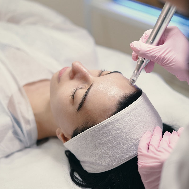 Dermapen Facial con Peeling