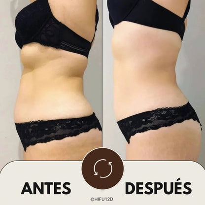 Vacuum Sculpt Pro - Pack Remodelación Corporal con EVO 3D + Ondas