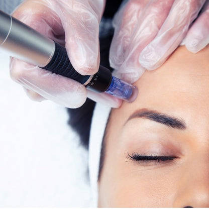 Hidra Dermapen facial EMS + Peeling