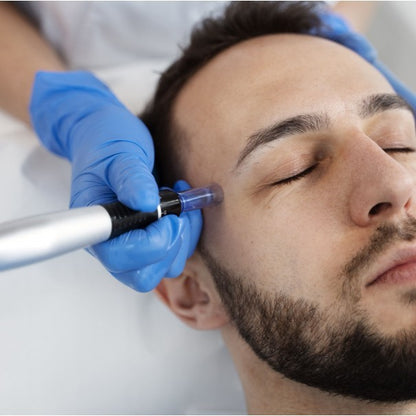 Hidra Dermapen facial EMS + Peeling
